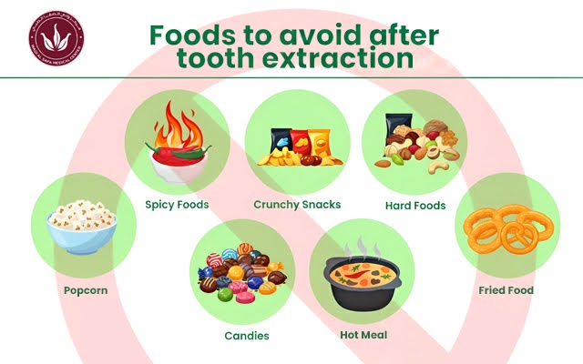 foods-to-avoid-after-dental-extraction
